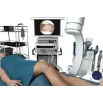 knee-arthroscopy