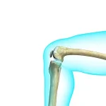 partial-knee-replacement