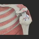 rotator-cuff-repair