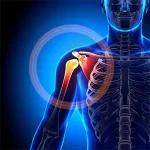 shoulder-disorders