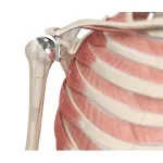 shoulder-joint-replacement